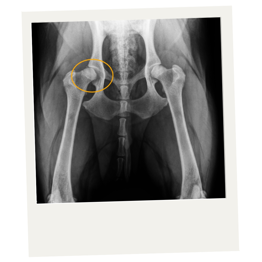 X-ray highlighting a misshapen hip socket.